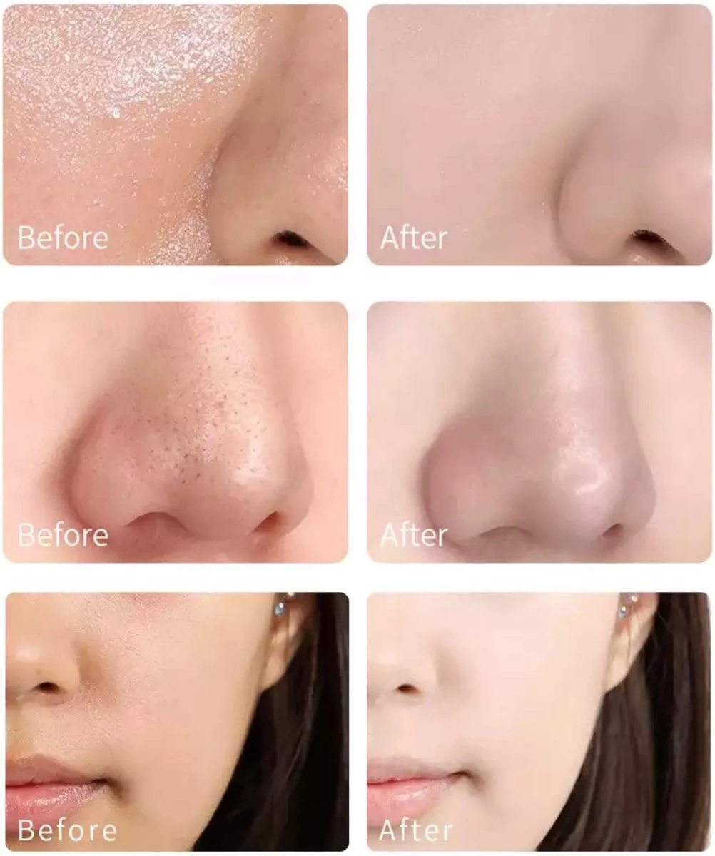 Plently - 1 + 1 Gratis - Groene Thee Masker - Green Mask Stick - 100% Natuurlijk Masker - Gezichtsmasker - Klei Masker - Anti Acne Masker - Verzorgend Masker - Groene Thee - Huidverzorging - Verkoelend - Hydraterend - Hoge Kwaliteit 2 Plently - 1 + 1 Gratis - Groene Thee Masker - Green Mask Stick - 100% Natuurlijk Masker - Gezichtsmasker - Klei Masker - Anti Acne Masker - Verzorgend Masker - Groene Thee - Huidverzorging - Verkoelend - Hydraterend - Hoge Kwaliteit - Afbeelding 2