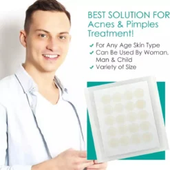 Pimple Patches - Acne Patches - Pimple Patch - Puisten Pleisters - Acne Pleister - 108 Stuks 9 Pimple Patches - Acne Patches - Pimple Patch - Puisten Pleisters - Acne Pleister - 108 Stuks -Zacht Huid Verkoop 1170x1200 3