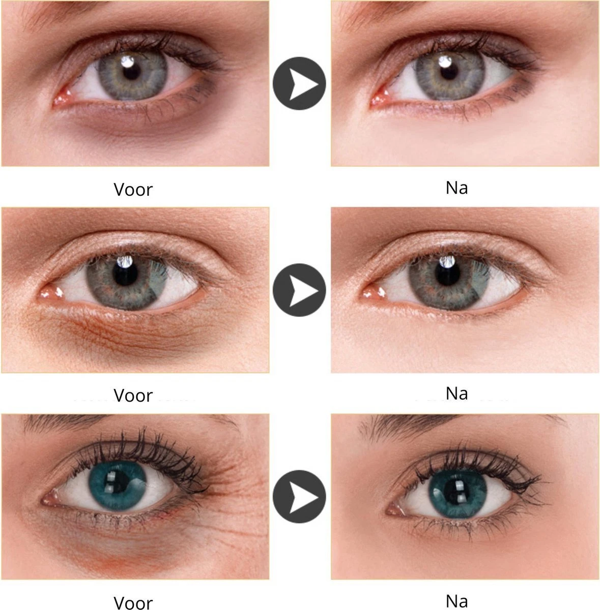 Merkloos LANBENA - Collageen Oogmasker - 24K Goud Oog Masker Patch - 60 Stuks (30 Paar) - Wallen En Donkere Kringen Wegwerken - Anti Age 3 Merkloos LANBENA - Collageen Oogmasker - 24K Goud Oog Masker Patch - 60 Stuks (30 Paar) - Wallen En Donkere Kringen Wegwerken - Anti Age - Afbeelding 3