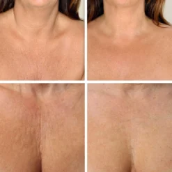 Simia™ Anti Rimpel Beauty Pads - Decolleté Large T Shape Set (2 Stuks) - Herbruikbaar Anti Aging Siliconen Pad Tegen Lijntjes En Slaaprimpels 9 Simia™ Anti Rimpel Beauty Pads - Decolleté Large T Shape Set (2 Stuks) - Herbruikbaar Anti Aging Siliconen Pad Tegen Lijntjes En Slaaprimpels -Zacht Huid Verkoop 1200x1139 1