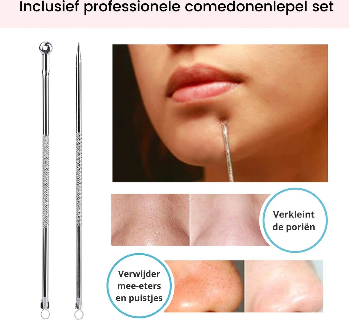Acne Patches (108x) Met Blackhead Remover Set - Puisten Pleister - Puisten Verwijderaar - 108 Pleisters In 2 Formaten - Mee Eters Verwijderen - Pimple Patch Voor Acneverzorging Met Comedonenlepel Set - Acne Stickers 5 Acne Patches (108x) Met Blackhead Remover Set - Puisten Pleister - Puisten Verwijderaar - 108 Pleisters In 2 Formaten - Mee Eters Verwijderen - Pimple Patch Voor Acneverzorging Met Comedonenlepel Set - Acne Stickers - Afbeelding 5