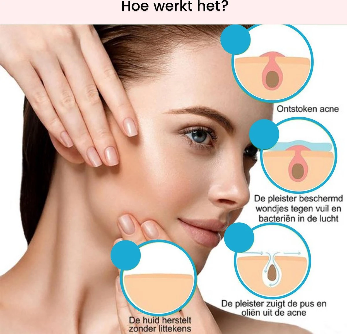 Acne Patches (108x) Met Blackhead Remover Set - Puisten Pleister - Puisten Verwijderaar - 108 Pleisters In 2 Formaten - Mee Eters Verwijderen - Pimple Patch Voor Acneverzorging Met Comedonenlepel Set - Acne Stickers 3 Acne Patches (108x) Met Blackhead Remover Set - Puisten Pleister - Puisten Verwijderaar - 108 Pleisters In 2 Formaten - Mee Eters Verwijderen - Pimple Patch Voor Acneverzorging Met Comedonenlepel Set - Acne Stickers - Afbeelding 3