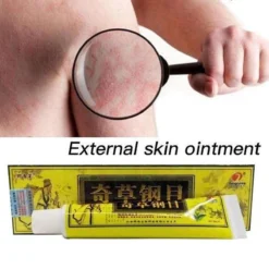 Psoriasis/exzeem Chineese Creme -Zacht Huid Verkoop 1200x1200 1153