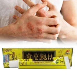 Psoriasis/exzeem Chineese Creme -Zacht Huid Verkoop 1200x1200 1154
