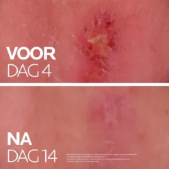 La Roche-Posay Cicaplast Balsem B5+ - 100ml - Voor Gevoelige Huid 18 La Roche-Posay Cicaplast Balsem B5+ - 100ml - Voor Gevoelige Huid -Zacht Huid Verkoop 1200x1200 1237