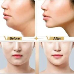 Facelift Masker - Gezicht Afslank Masker V-Line -Zacht Huid Verkoop 1200x1200 233