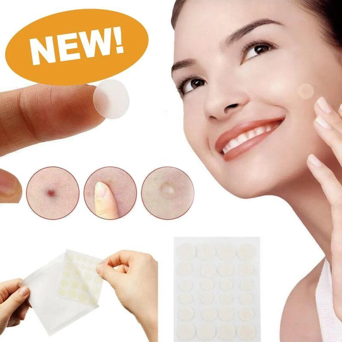 Merkloos Pimple Patch - Acne Patch - Puisten Patch - Acne Sticker - Puisten Pleister - Pimple Patches - Acne Pleister - Puisten Verwijderaar - Puisten Creme - Acne Verwijderen Set - Acneverzorging | 36 Stuks & Directe Levering 1 Merkloos Pimple Patch - Acne Patch - Puisten Patch - Acne Sticker - Puisten Pleister - Pimple Patches - Acne Pleister - Puisten Verwijderaar - Puisten Creme - Acne Verwijderen Set - Acneverzorging | 36 Stuks & Directe Levering