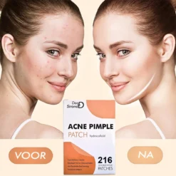 Dea Sirona Pimple Patch - Acne Patch - Puisten Verwijderaar - Puisten Pleister - Acne Pleister - Acne Sticker - Puistjes Verwijderen - 216 Stuks 15 Dea Sirona Pimple Patch - Acne Patch - Puisten Verwijderaar - Puisten Pleister - Acne Pleister - Acne Sticker - Puistjes Verwijderen - 216 Stuks -Zacht Huid Verkoop 1200x1200 881