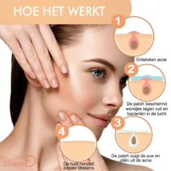 Dea Sirona Pimple Patch - Acne Patch - Puisten Verwijderaar - Puisten Pleister - Acne Pleister - Acne Sticker - Puistjes Verwijderen - 216 Stuks 19 Dea Sirona Pimple Patch - Acne Patch - Puisten Verwijderaar - Puisten Pleister - Acne Pleister - Acne Sticker - Puistjes Verwijderen - 216 Stuks -Zacht Huid Verkoop 1200x1200 883