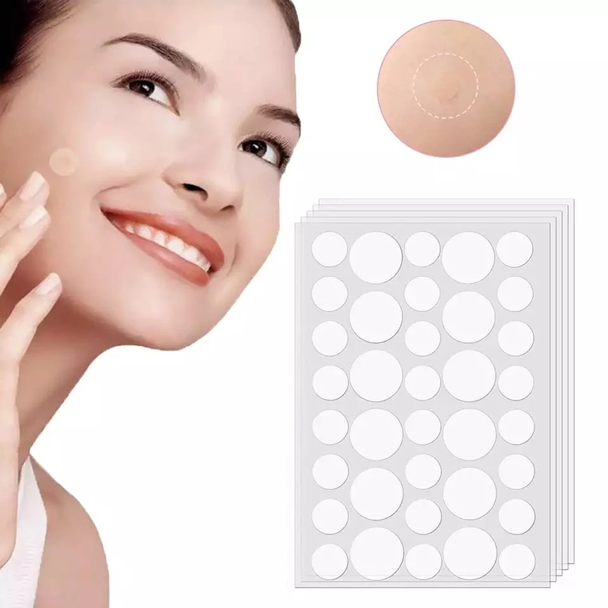 Pimple Patches - Acne Patches - Pimple Patch - Puisten Pleisters - Acne Pleister - 108 Stuks 2 Pimple Patches - Acne Patches - Pimple Patch - Puisten Pleisters - Acne Pleister - 108 Stuks - Afbeelding 2