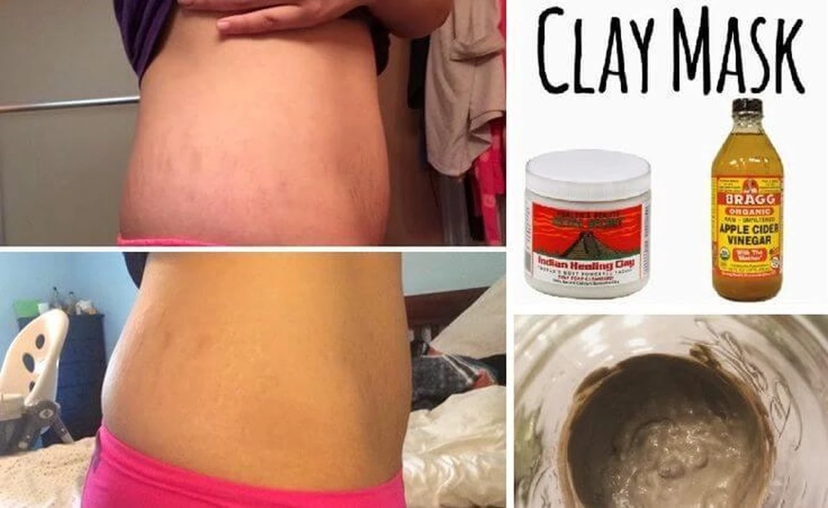 Aztec Secret Indian Healing Clay Gezichtsmasker - 454 G - 100% Natuurlijke Betonine Clay - New Formula 2 Aztec Secret Indian Healing Clay Gezichtsmasker - 454 G - 100% Natuurlijke Betonine Clay - New Formula - Afbeelding 2